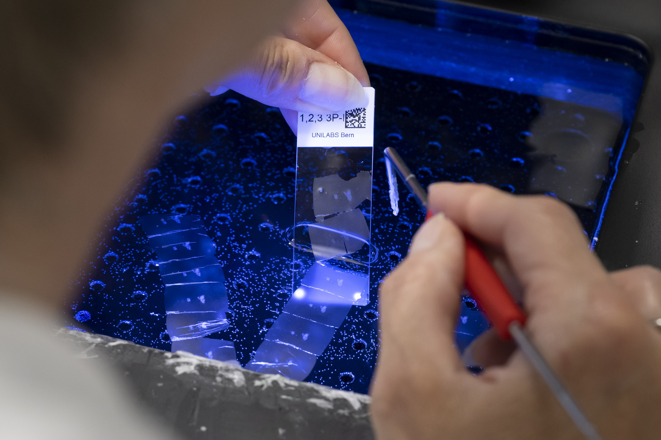 Eine Labortechnikerin arbeitet an einem histologischen Objektträger in einem Labor für digitale Pathologie in Bern. Künstliche Intelligenz (KI) soll die Bestimmung und Behandlung von Krebs erleichtern.