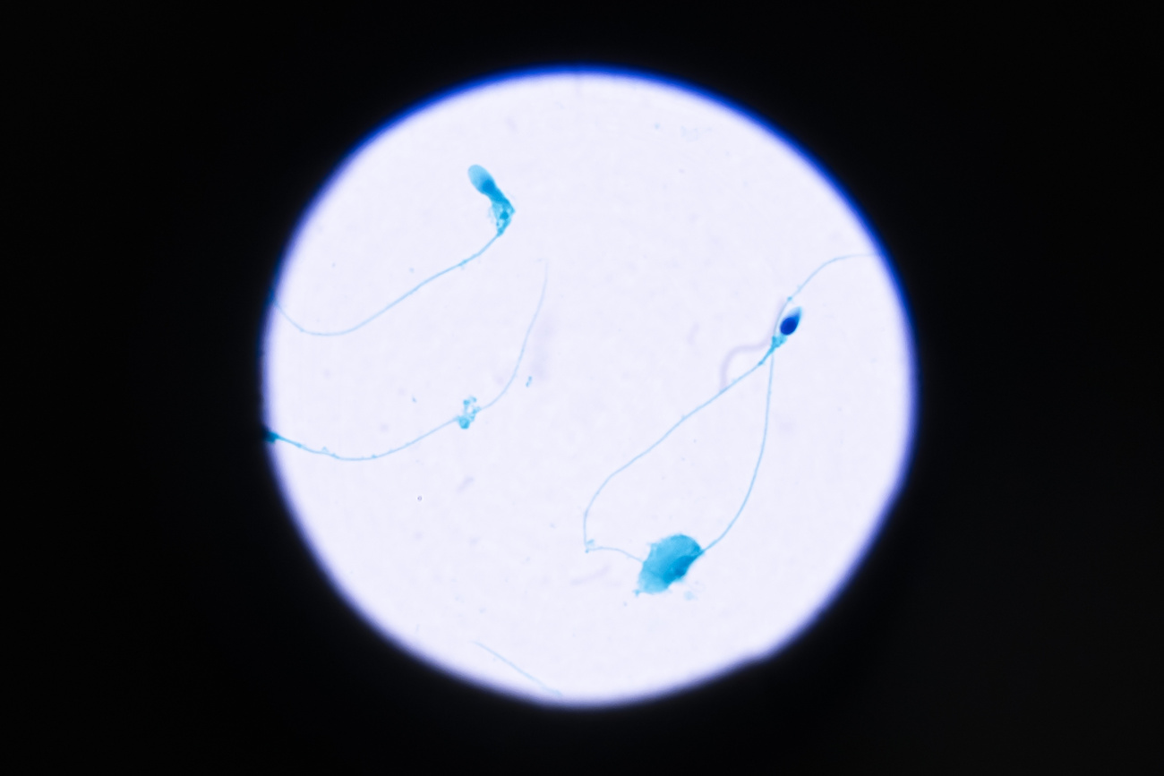 spermatozoi al microscopio