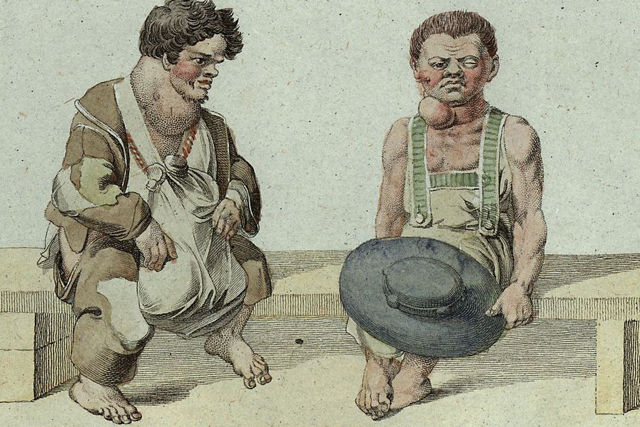 The Swiss medical breakthrough that cured the ‘cretins of the Alps’ The Swiss medical breakthrough that cured the ‘cretins of the Alps’