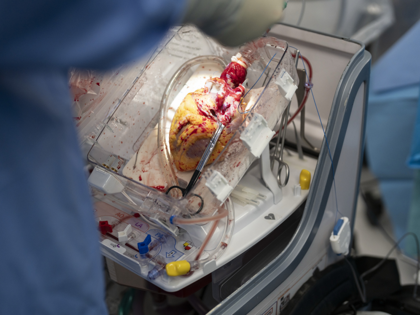 Switzerland imports record number of organs Switzerland imports record number of organs