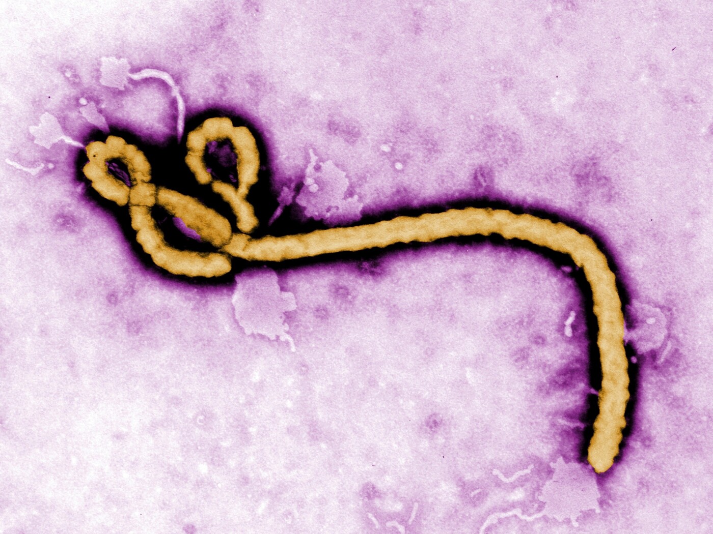 Ebola epidemic: WHO declares an international health emergency
