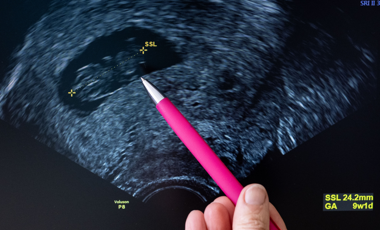 Radiografia e um lápis apontando