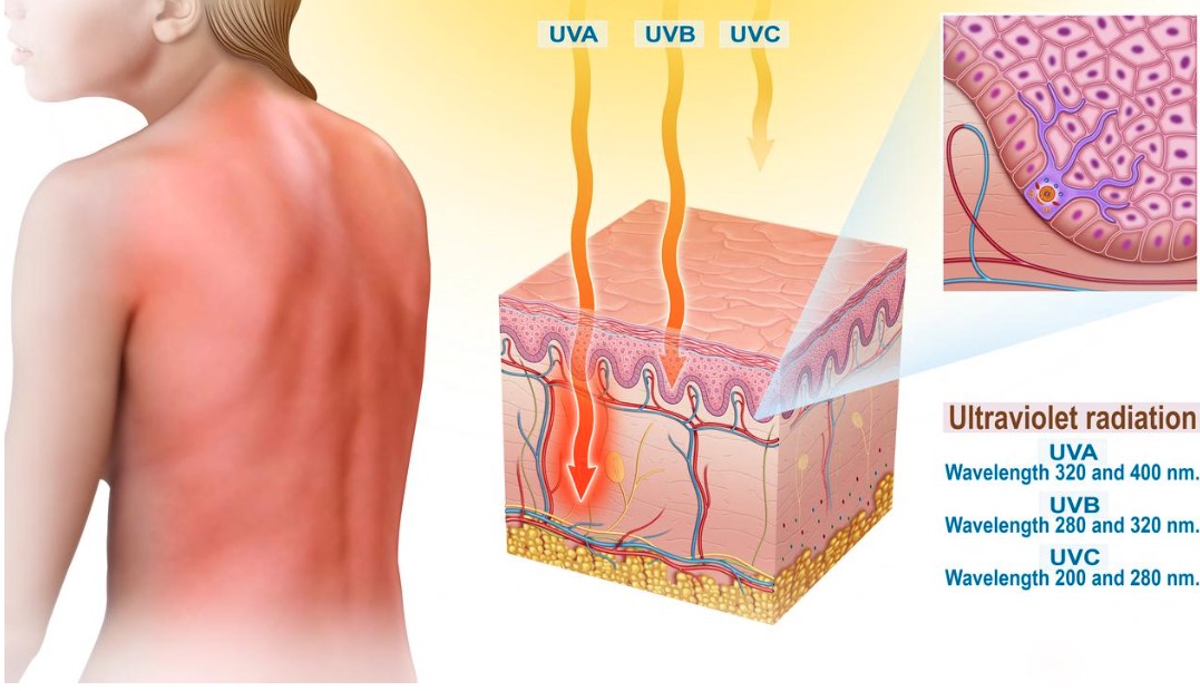 Au contraire des UV-C qui n'arrivent pas à la surface de la Terre, les UV-B, principaux responsables des coups de soleil, atteignent la couche superficielle de la peau, l'épiderme, tandis que les UV-A pénètrent plus profondément, jusqu'au derme.