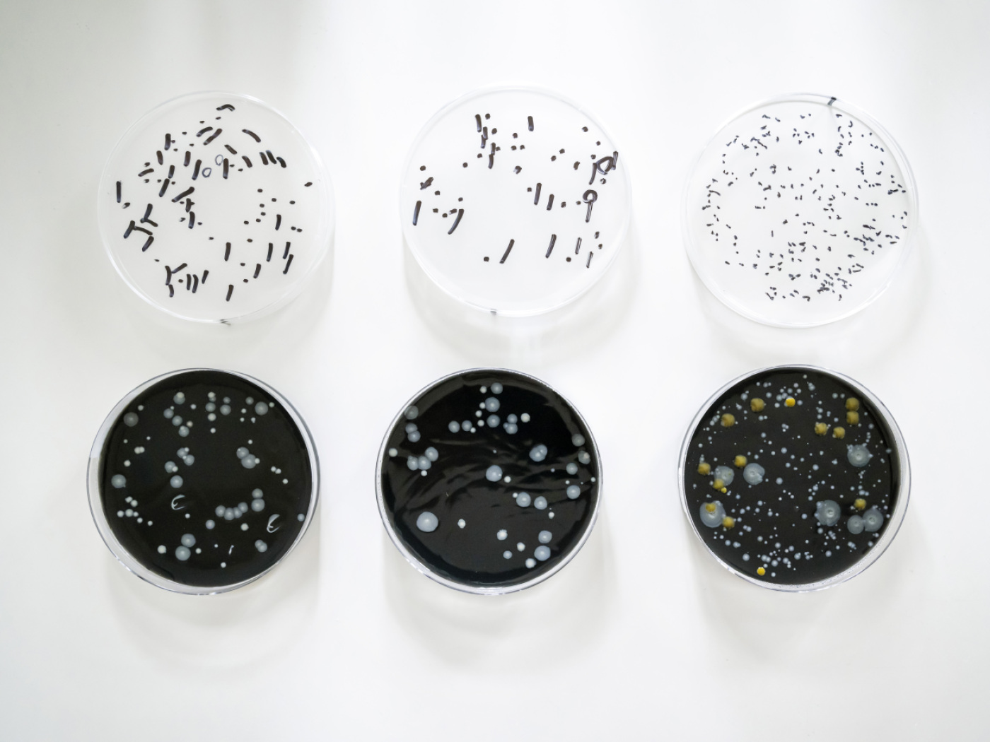 Two new cases of Legionnaires’ disease in the canton of Basel-Stadt