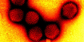 Un Killer Per Il Cancro Del Colon SWI Swissinfo ch