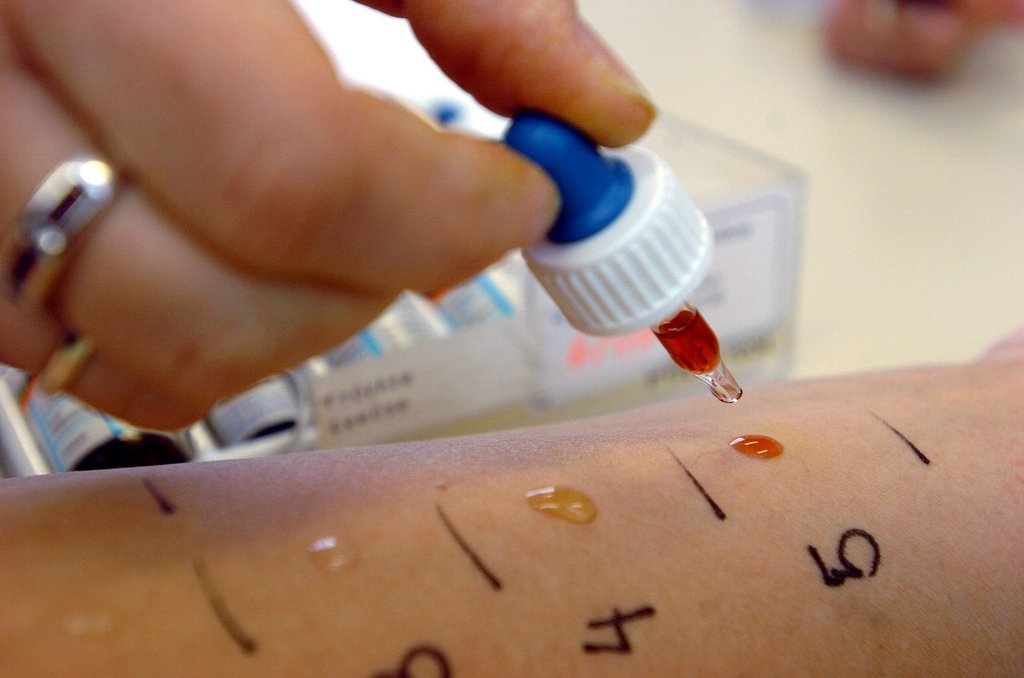 New findings could help treat acute allergies SWI swissinfo.ch