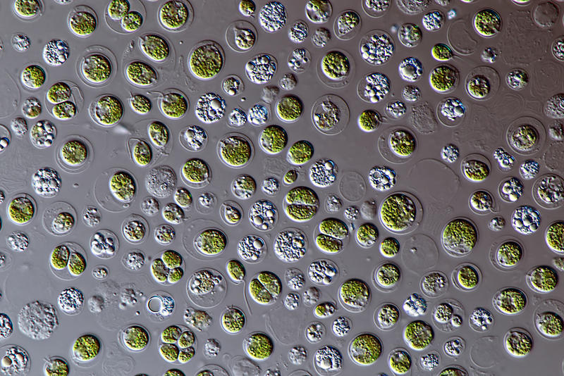 Study shows mercury disrupts algae metabolism - SWI swissinfo.ch