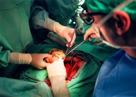 心臓外科手術