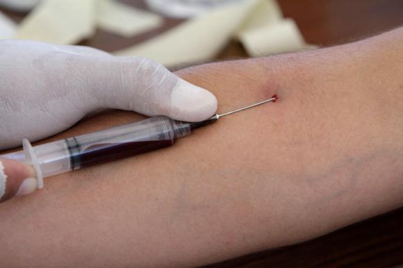 needle drawing blood