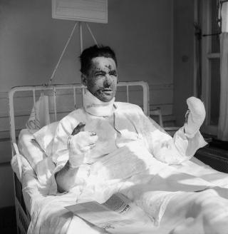 Hombre vendado y enyesado en una cama de hospital.