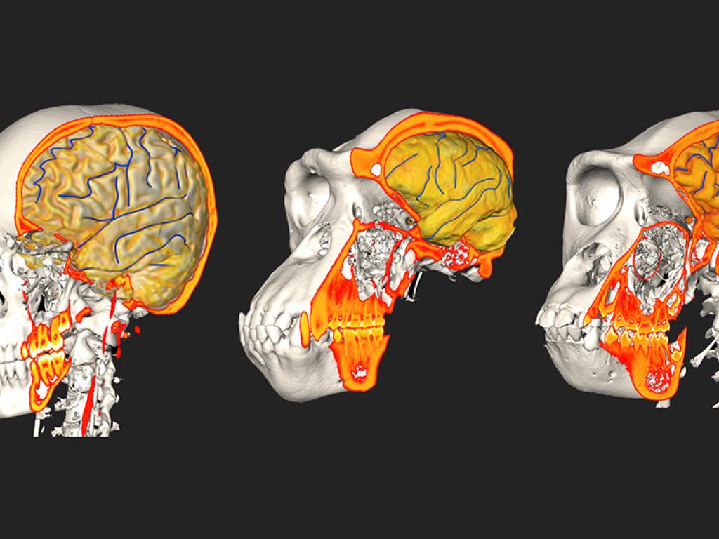 L évolution Du Cerveau Humain Depuis Préhistoire Le cerveau et le crâne ont évolué de manière largement indépendante