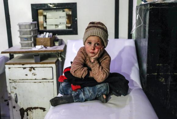 طفلٌ سوري مُصاب يجلس على سرير في مستشفى بمدينة دوما شرق الغوطة
