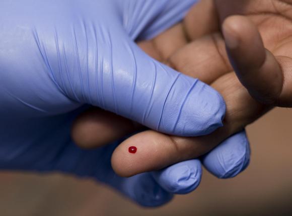 Foto de análisis de sangre. Una mano enguantada sostiene la mano del paciente con una gota de sangre en un dedo.