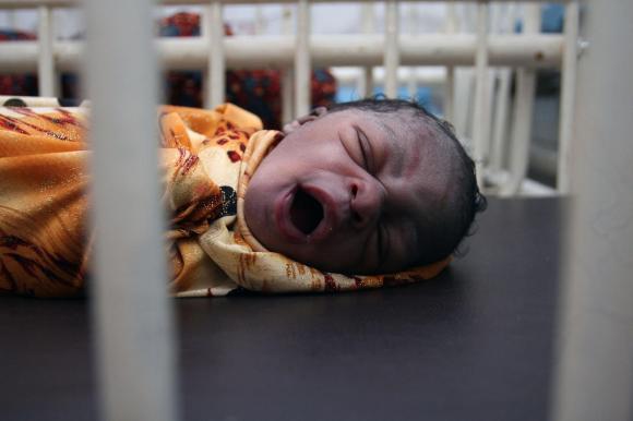 Bild eines gähnenden Neugeborenen.