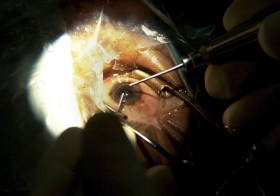 22615795_highres.jpg?profile=RESIZE_710x