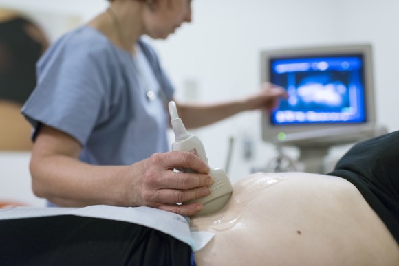 Ultrasound of a pregnant woman