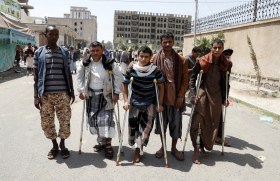 Injured Yemenis