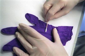 DNA being extracted from a glove