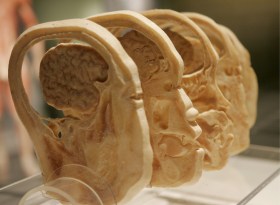 Sections of brain