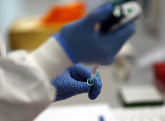 Laboratory sequencing in operation