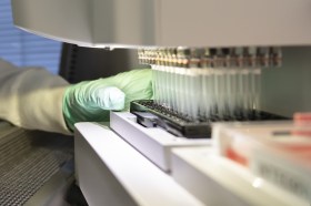 Aducanumab drug
