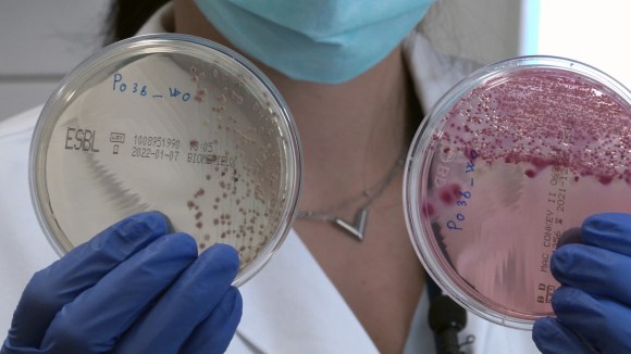 Forscherin zeigt zwei in Petrischalen angesetzte Stuhlproben