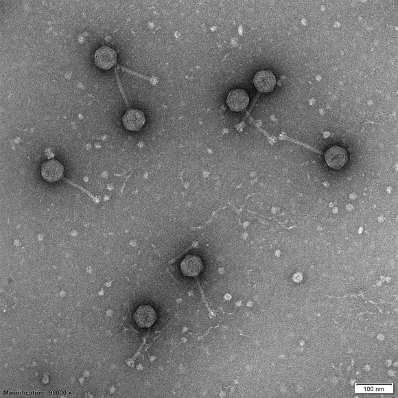 batteriofagi al microscopio elettronico