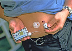 Roaccutan preis schweiz